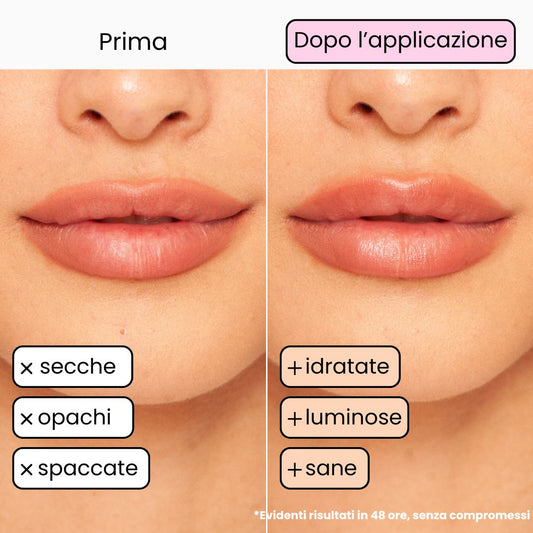 Balsamo Labbra BERRY - Mora e Mirtillo