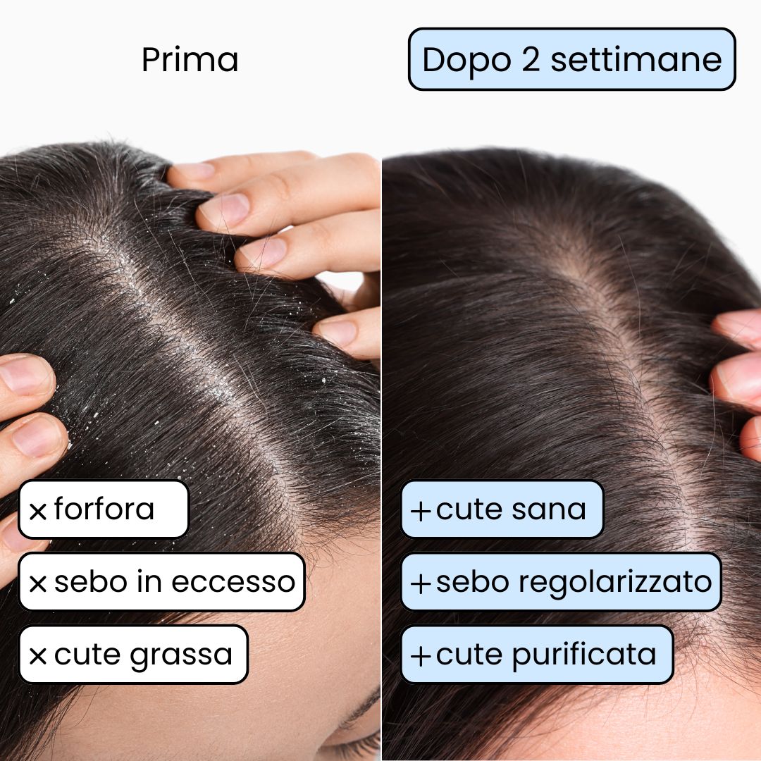 Reinigendes festes Shampoo für fettiges Haar x2