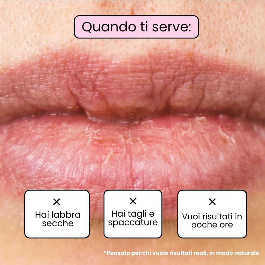 Lippenbalsam BERRY - Brombeere und Heidelbeere
